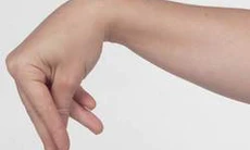 Suy tuyến cận giáp: Nguyên nhân gây hạ calci máu